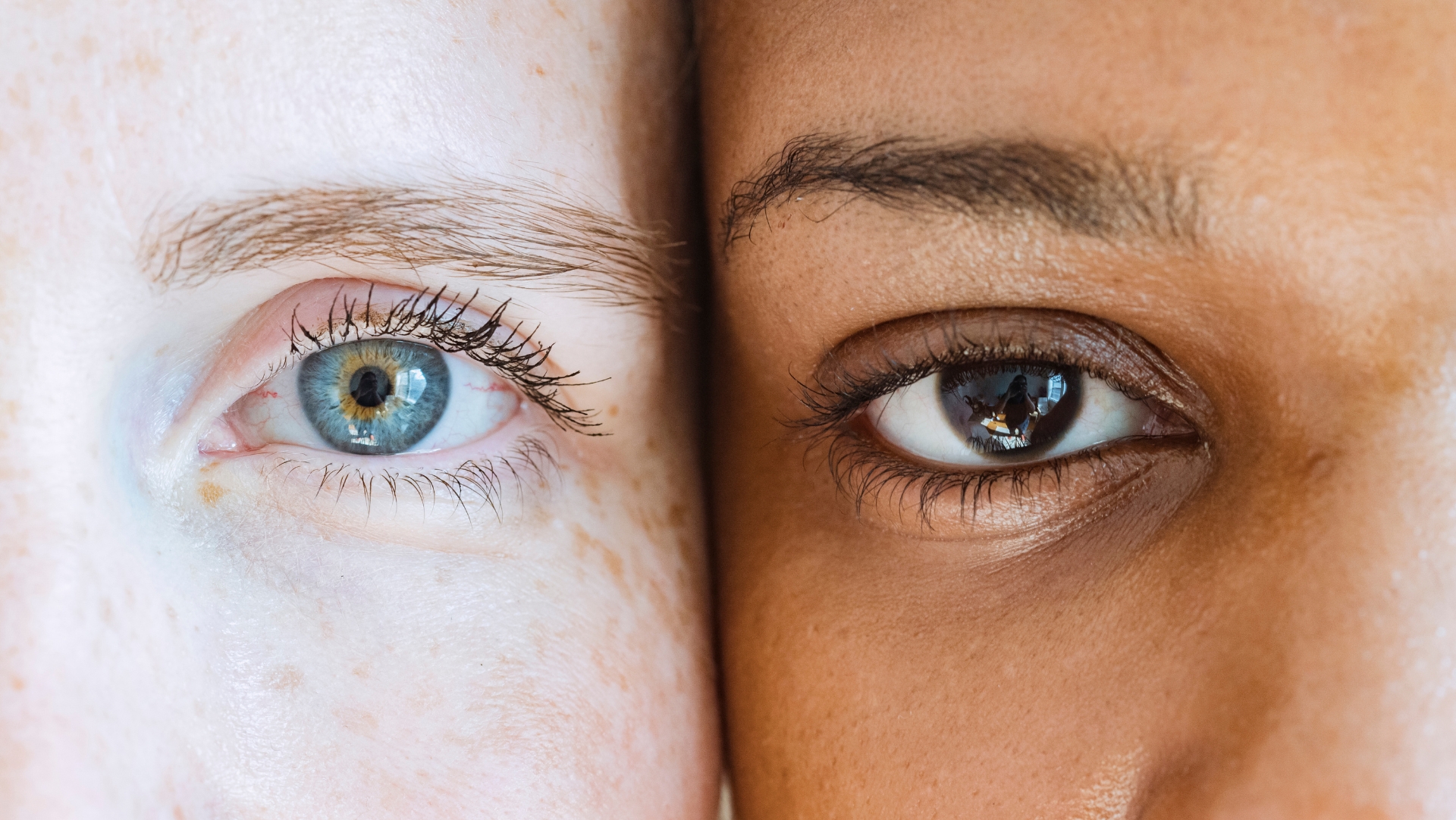 Two different colored eyes