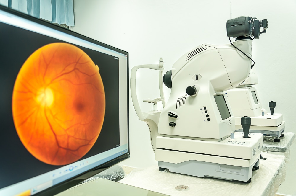Cataract Surgery Billing: Where Ophthalmology Practices Leave Money on the Table